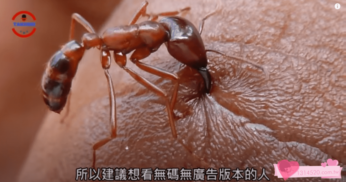 [生物放大鏡] 螞蟻縫合術與蛆蟲治療法 | 將螞蟻用於手術的驚人歷史 | 被蛆蟲拯救的士兵